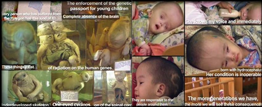 Nuclear radiation hurts & mutates children